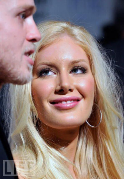 Celebrity Plastic Surgery Before & After