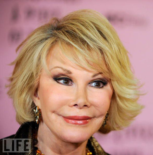 Celebrity Plastic Surgery Before & After