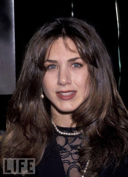 Celebrity Plastic Surgery Before & After