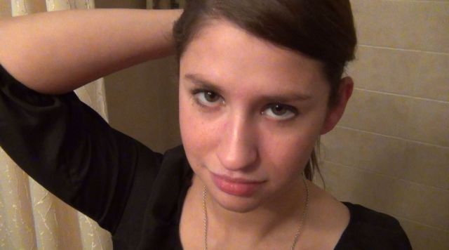 What a Brown Recluse Spider Bite Looks Like