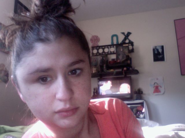 What a Brown Recluse Spider Bite Looks Like