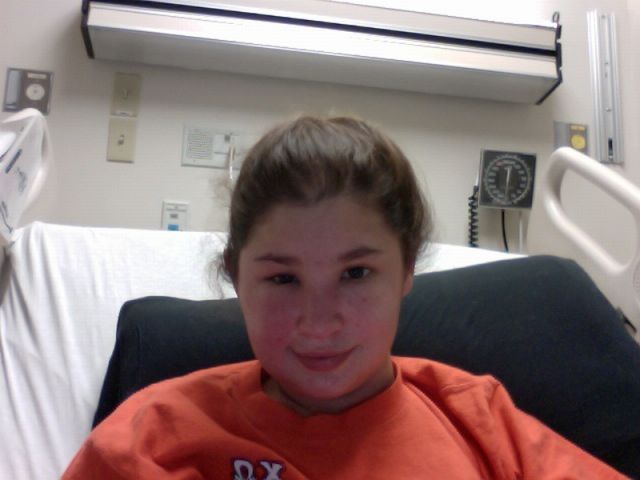 What a Brown Recluse Spider Bite Looks Like