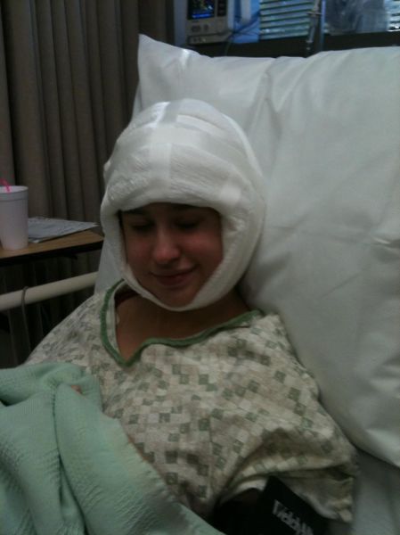 What a Brown Recluse Spider Bite Looks Like