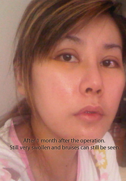 Woman Undergoes 10 Surgeries to Become Anime Character