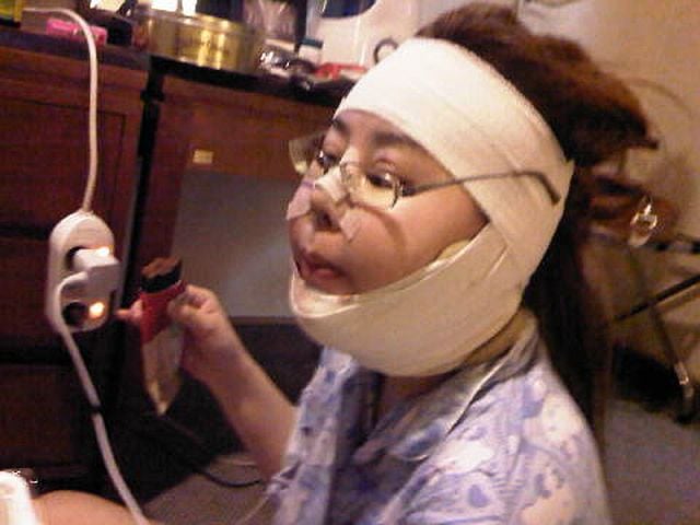 Woman Undergoes 10 Surgeries to Become Anime Character