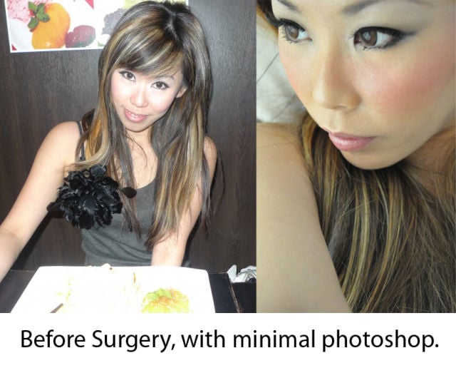 Woman Undergoes 10 Surgeries to Become Anime Character