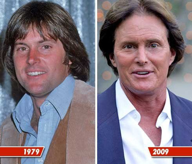 Celebrity Plastic Surgery Before & After