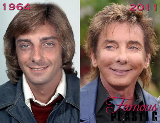 Celebrity Plastic Surgery Before & After