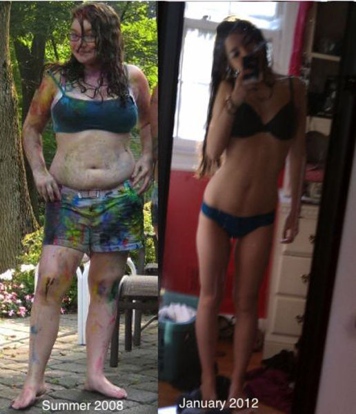 Once Chubby, Now Thin. Part 2