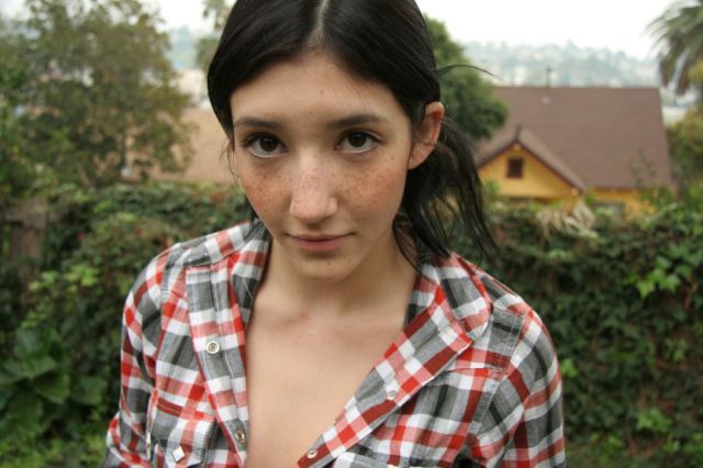 Freckles to the Front Please