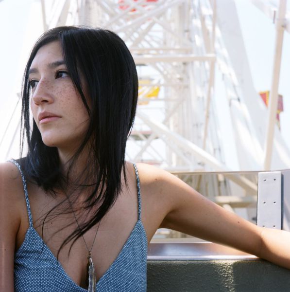 Freckles to the Front Please