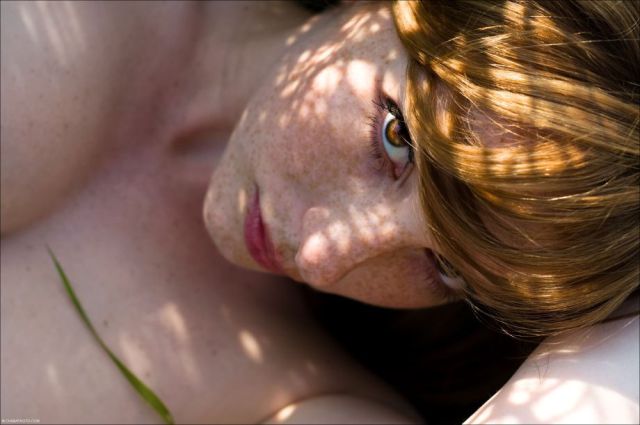 Freckles to the Front Please