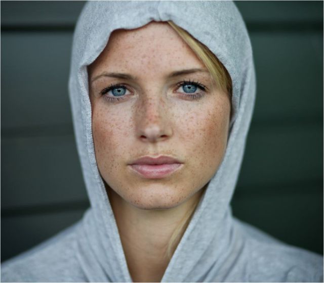 Freckles to the Front Please