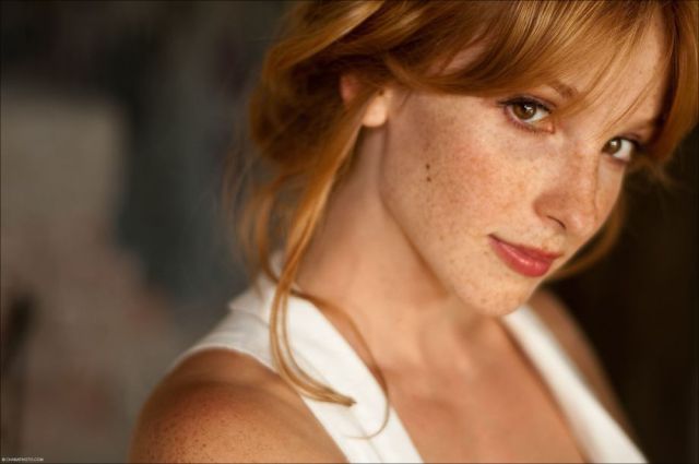 Freckles to the Front Please