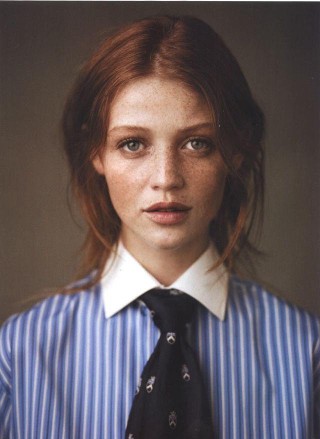 Freckles to the Front Please