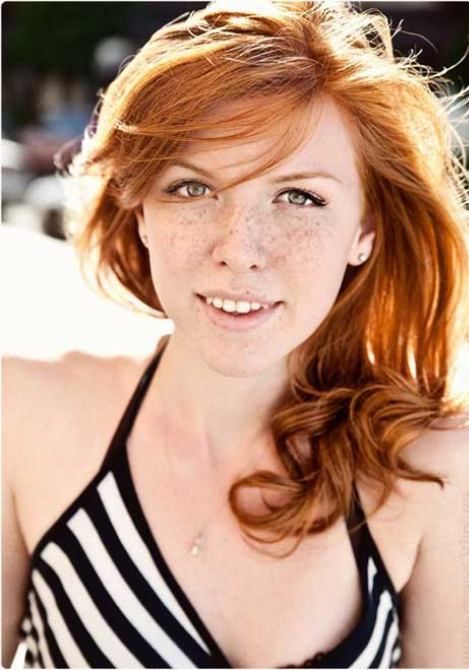 Freckles to the Front Please