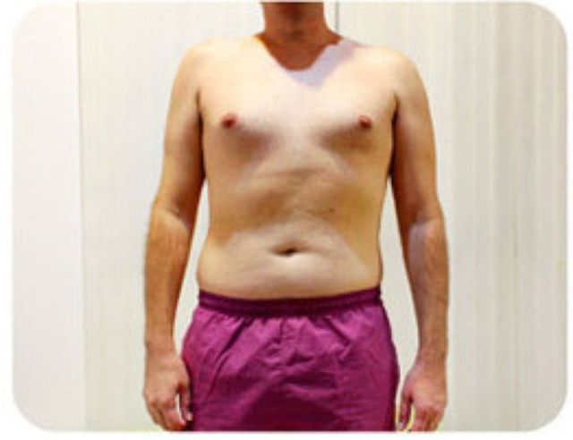 Is That Cleavage Real?