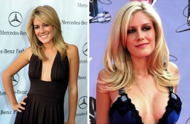 Celebs with the Worst Fake Breasts: Before and After