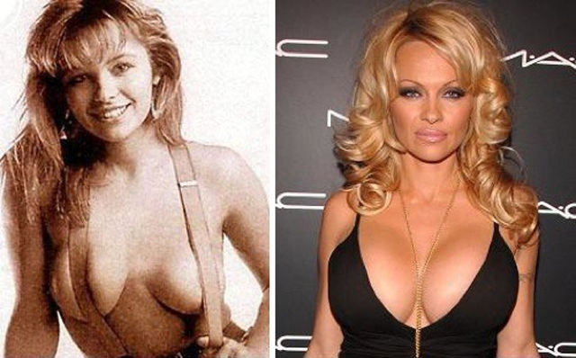 Celebs with the Worst Fake Breasts: Before and After