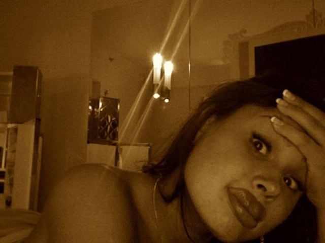 Ladies With Silicone Overdose