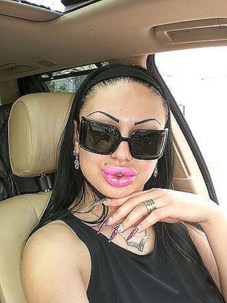 Ladies With Silicone Overdose