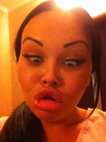 Ladies With Silicone Overdose