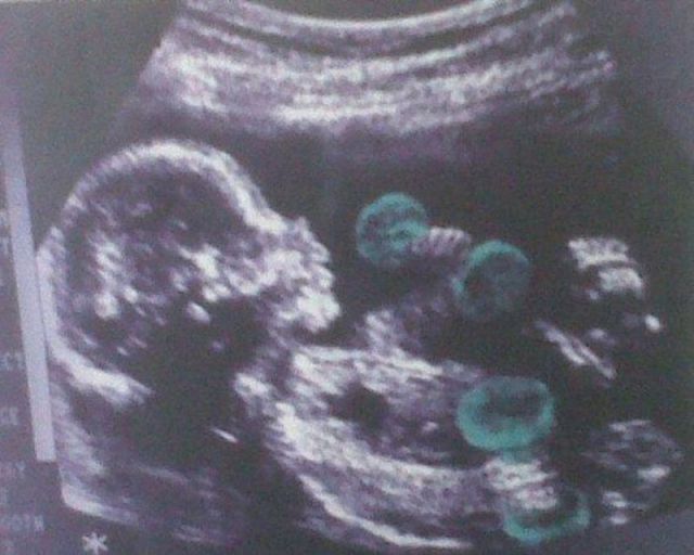 morning picdump 56 pics 42.html - 56 HD Photos | Premium Gallery 2012