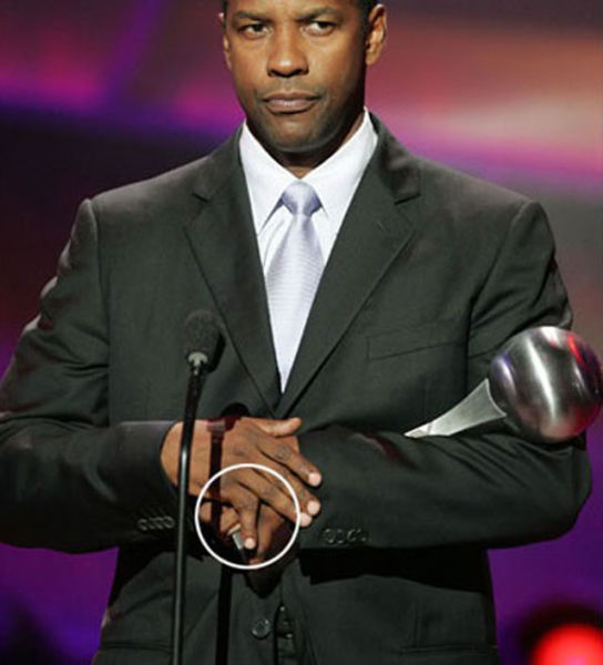 Celebs Have Imperfections Too!