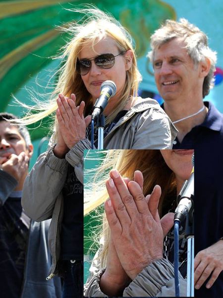 Celebs Have Imperfections Too!