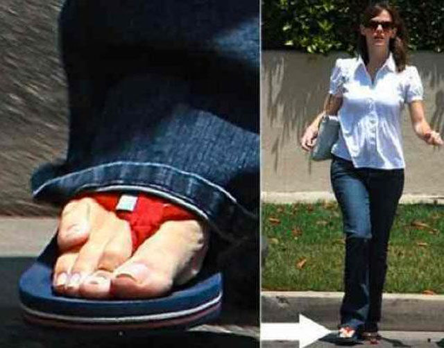 Celebs Have Imperfections Too!