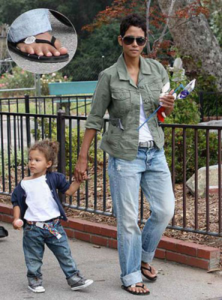 Celebs Have Imperfections Too!