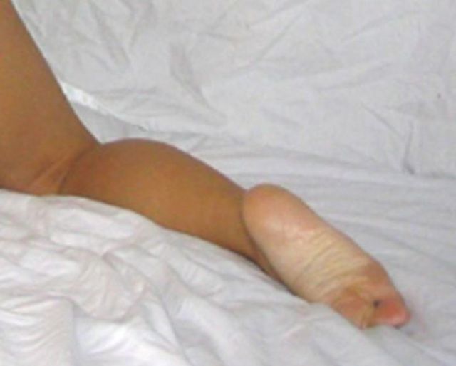 Celebs Have Imperfections Too!