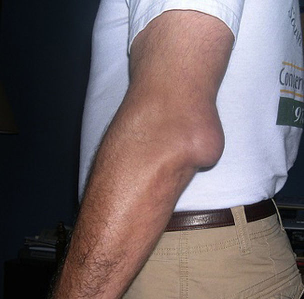 Celebs Have Imperfections Too!