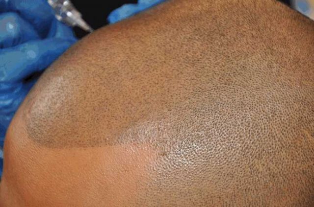 The ‘No Hair’ Solution!