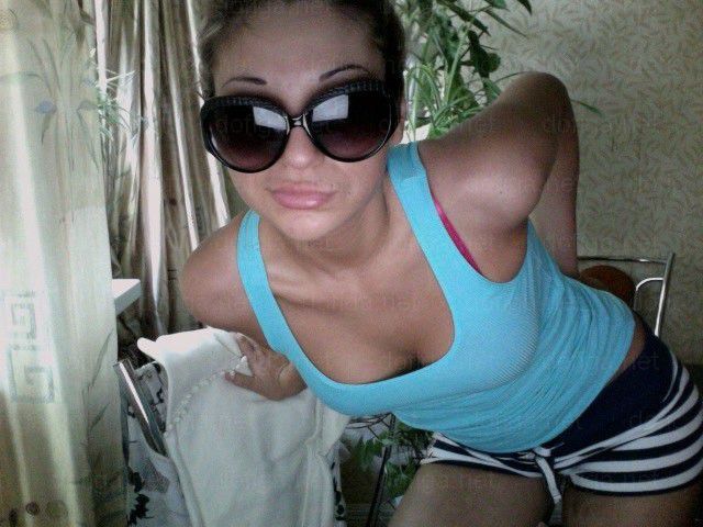 Before and After: Girl Gets a Dramatic Lip Enhancement