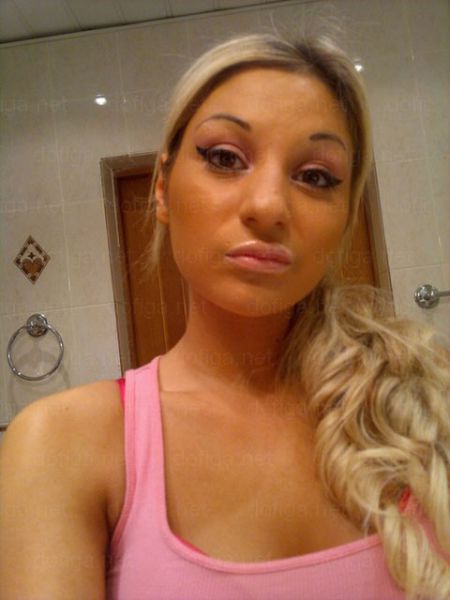 Before and After: Girl Gets a Dramatic Lip Enhancement