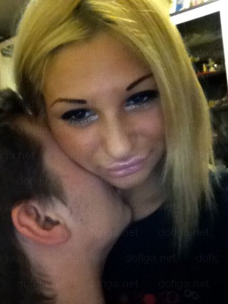 Before and After: Girl Gets a Dramatic Lip Enhancement