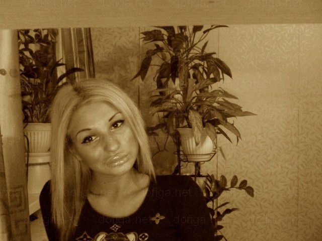 Before and After: Girl Gets a Dramatic Lip Enhancement