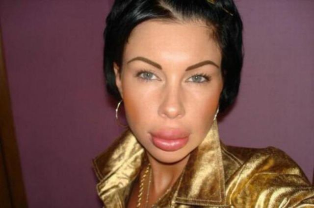 Sometimes Beauty Treatments Just Make You Ugly