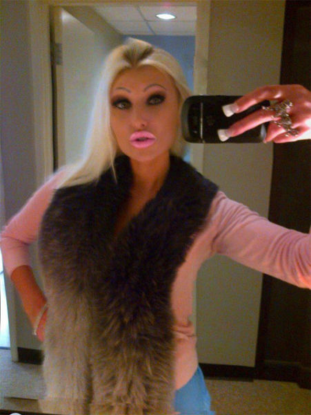 Sometimes Beauty Treatments Just Make You Ugly