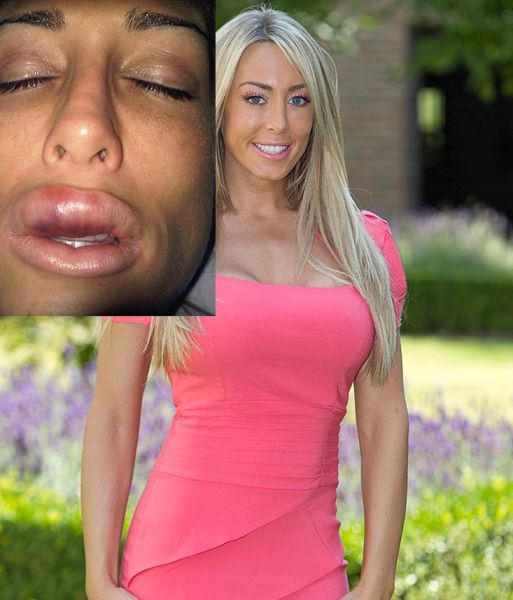 Sometimes Beauty Treatments Just Make You Ugly