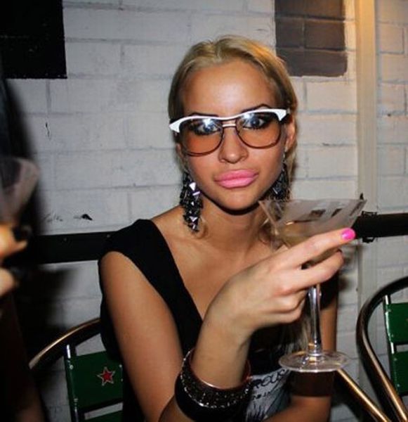 Sometimes Beauty Treatments Just Make You Ugly