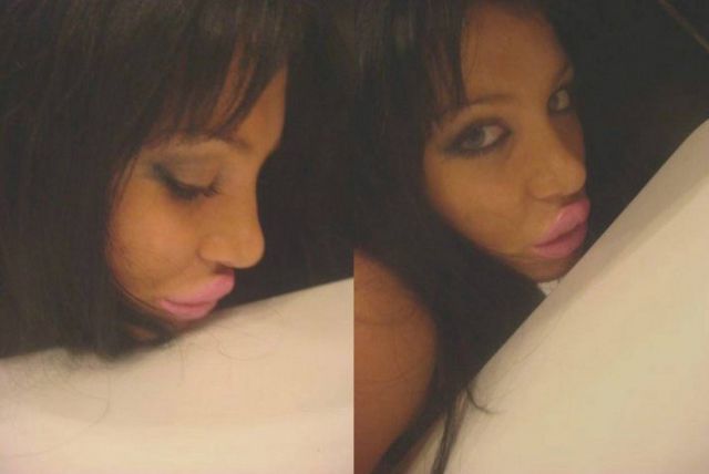 Sometimes Beauty Treatments Just Make You Ugly