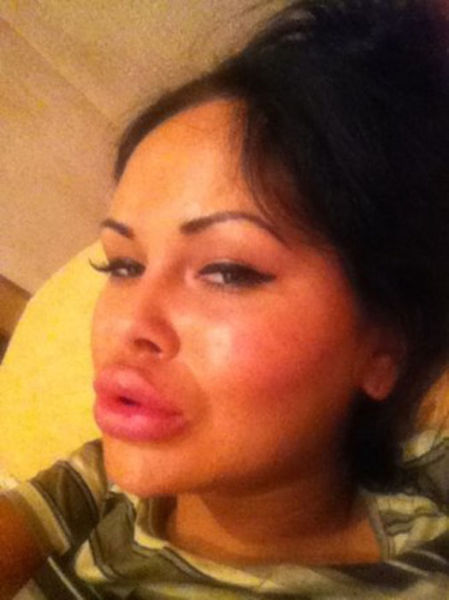 Sometimes Beauty Treatments Just Make You Ugly