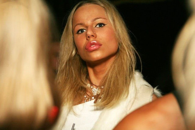 Sometimes Beauty Treatments Just Make You Ugly