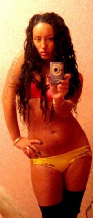 This Is What Excessive Plastic Surgery Looks Like