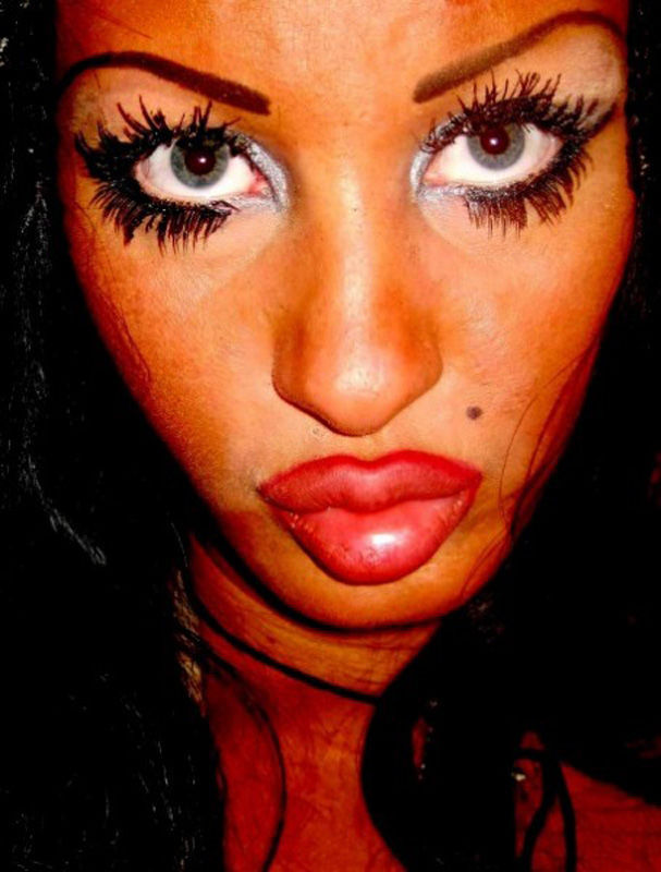 This Is What Excessive Plastic Surgery Looks Like