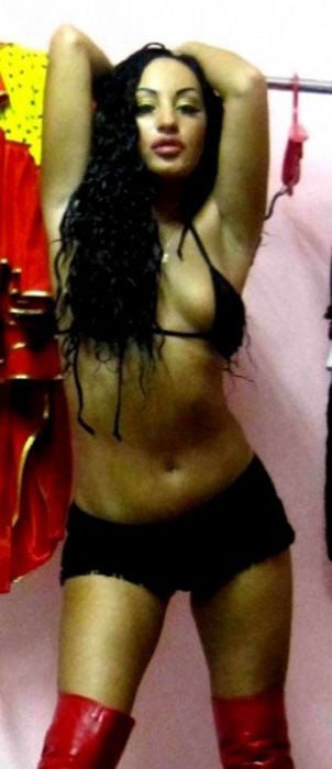 This Is What Excessive Plastic Surgery Looks Like