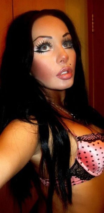 This Is What Excessive Plastic Surgery Looks Like