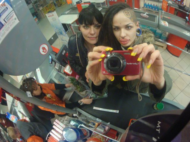 New Photos of the Girl with the World’s Largest Lips